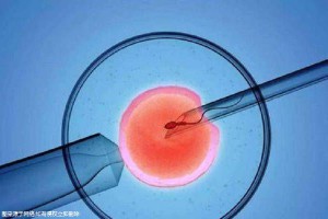 供卵代怀包生男孩机构门诊